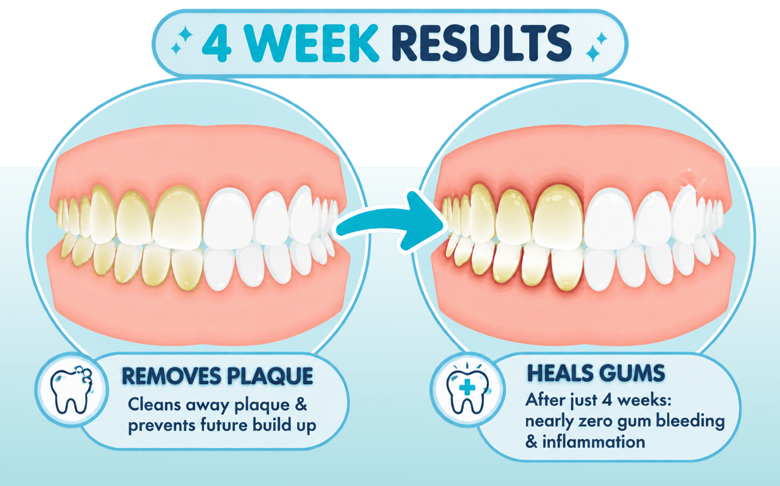 Four week plaque and gum results