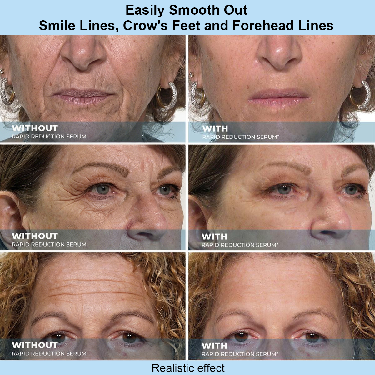 Eknest™ Instant Face Temporary Tightener – Instant visible results in 30 seconds