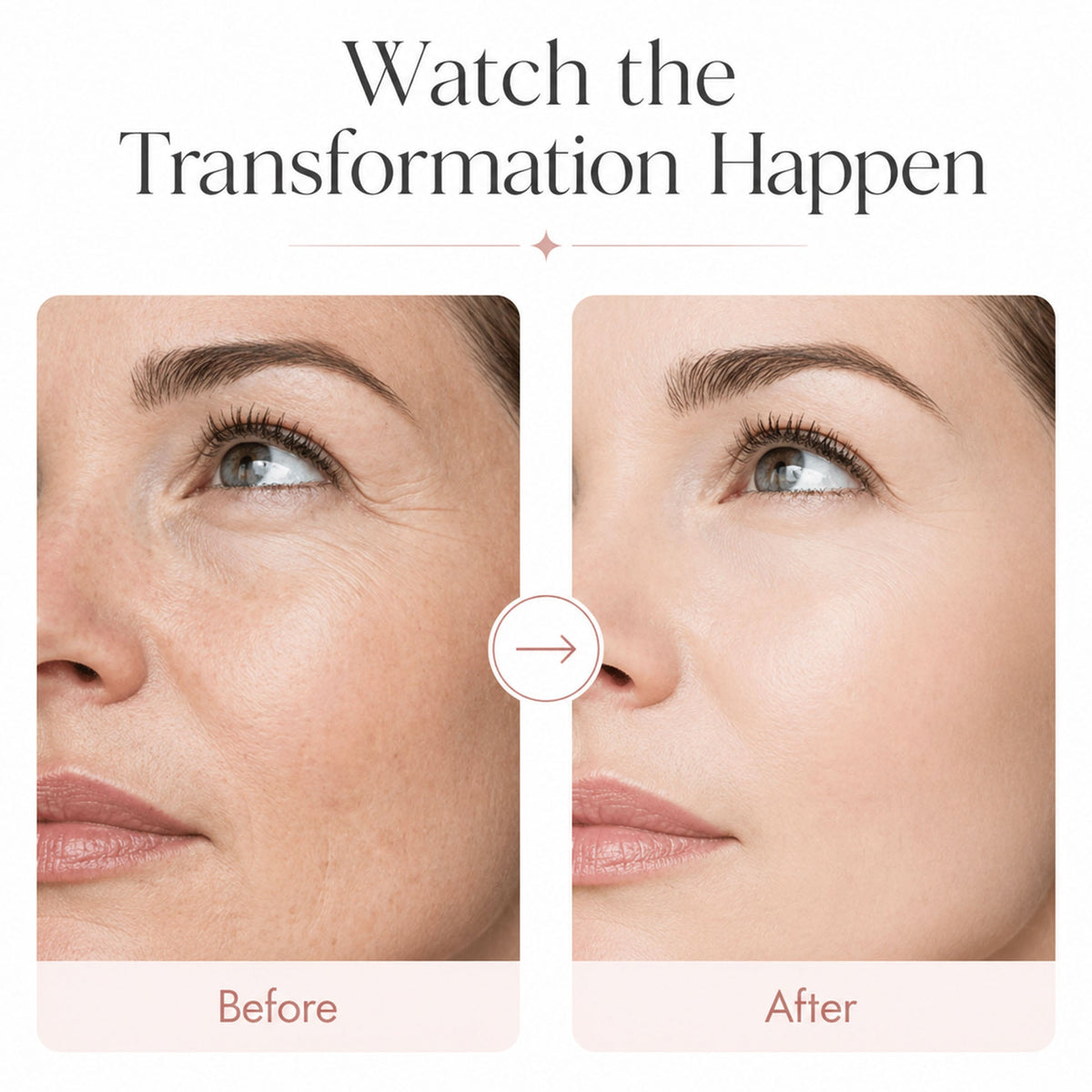 Eknest™ Time Reverse Cream (All-In-One)