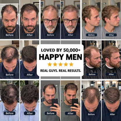 Hair Density Cream