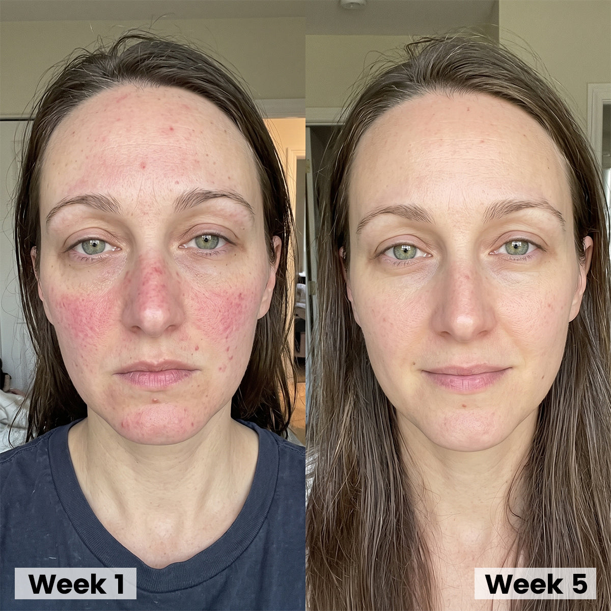 Korean Collagen Serum for Mature Skin