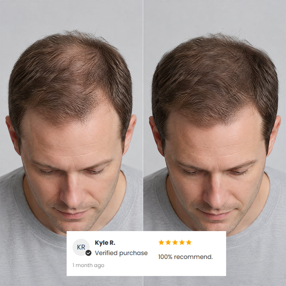 Hair Density Cream