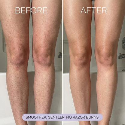Eknest Hair Removal Mousse