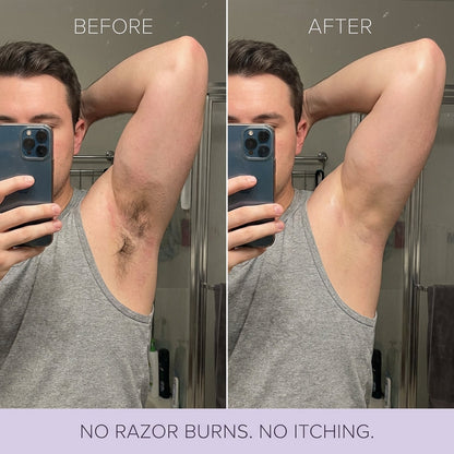 Eknest Hair Removal Mousse