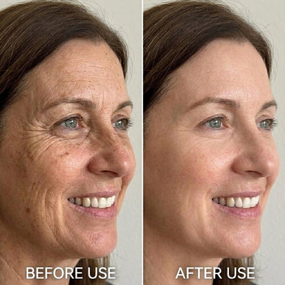 eknest Face Serum