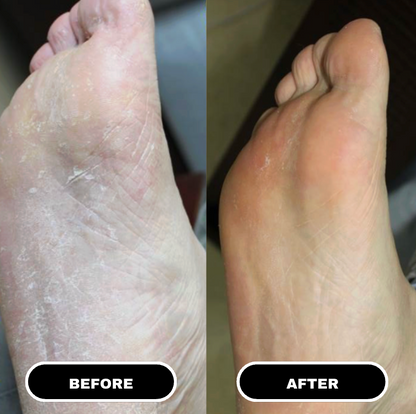 PureFoot Relief Stick — 4