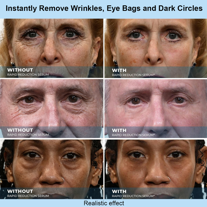 Eknest™ Instant Face Temporary Tightener – Instant visible results in 30 seconds