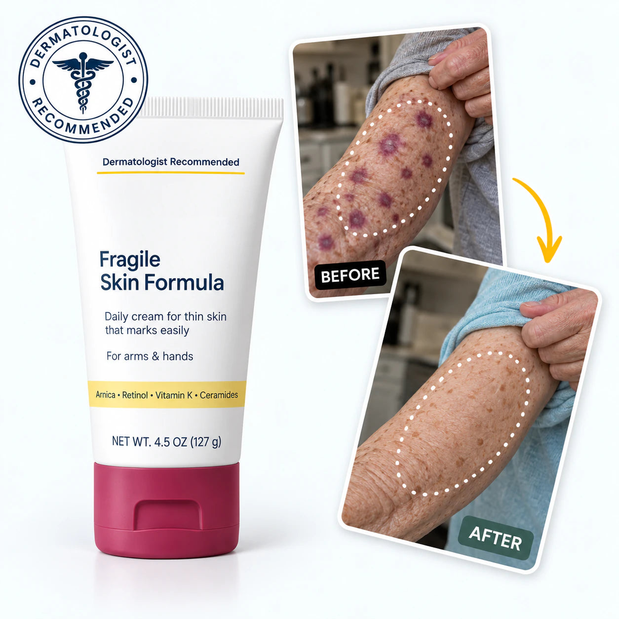  eknest  Fragile Skin Formula with before-and-after forearm imagery